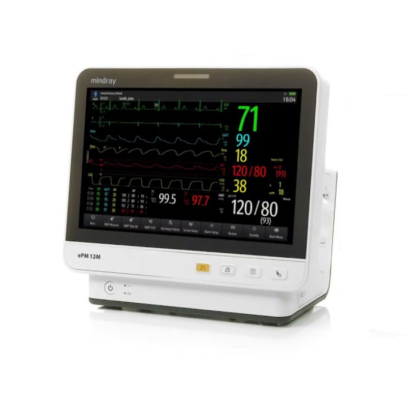 Монитор пациента прикроватный comen star. Модульный монитор пациента. Монитор пациента comen 8000c. Монитор пациента. Модульный монитор пациента.