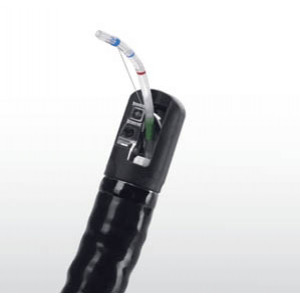 Видеодуоденоскоп  Sonoscape ED-5GT