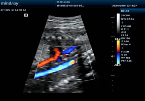 Цветовое представление аорты эмбриона